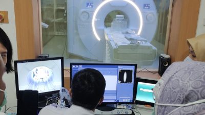 "Terobosan Baru: CT Scan dan MRI Bantu Deteksi Aneurisma Otak Secara Akurat"